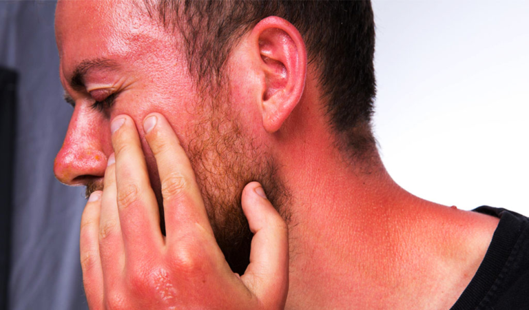 Nóng Mặt Là điềm Gì